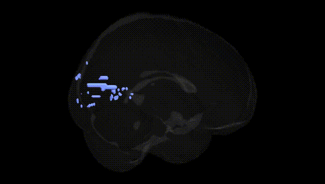 Full Brain Black