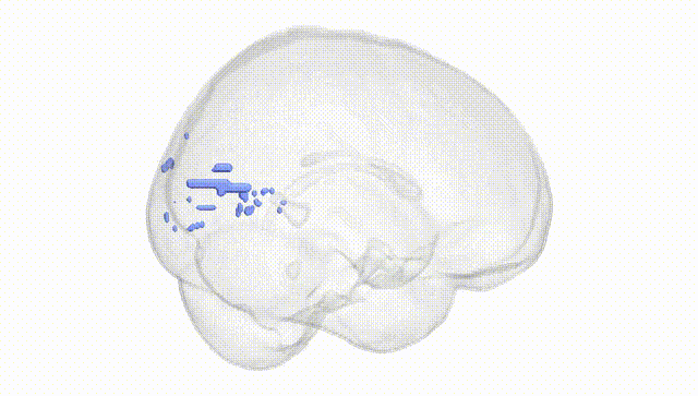 Full Brain White