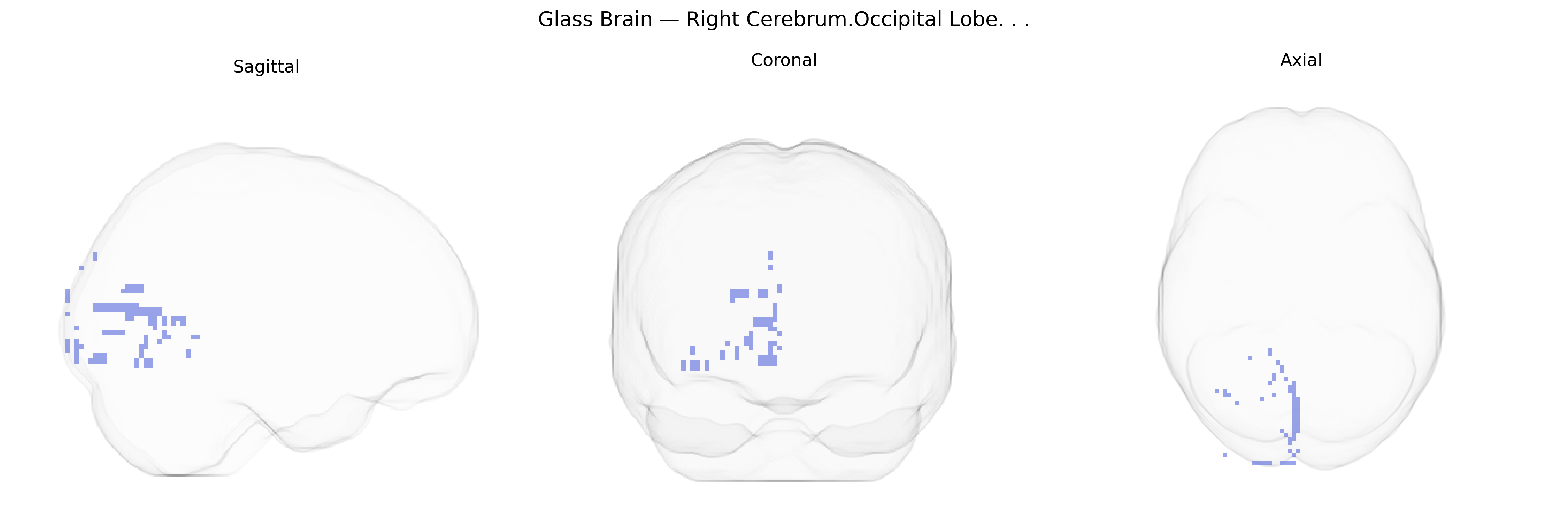 Triplanar Ghost Brain
