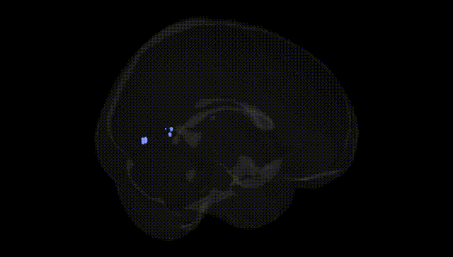 Full Brain Black
