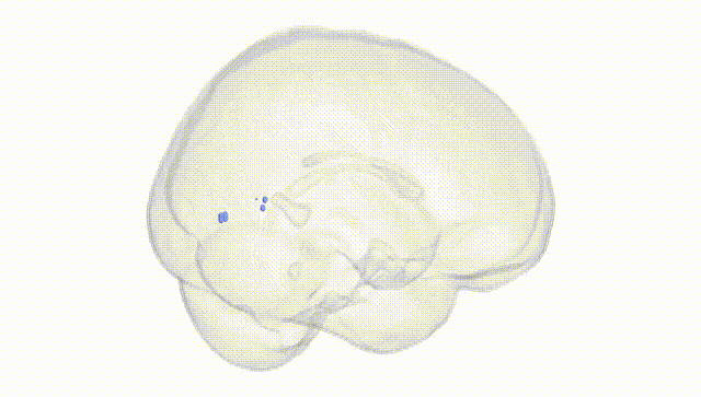 Full Brain White