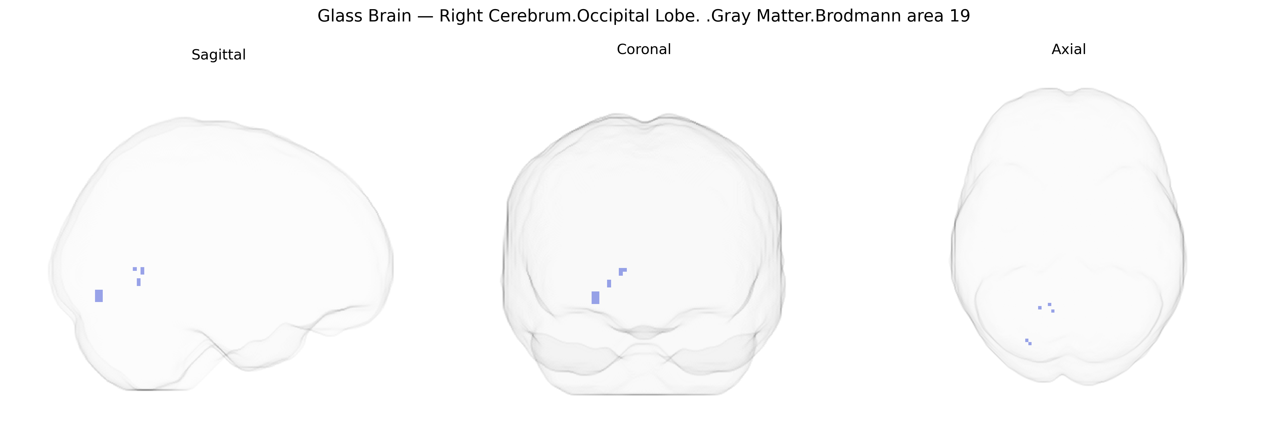 Triplanar Ghost Brain
