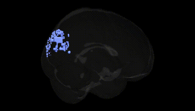 Full Brain Black