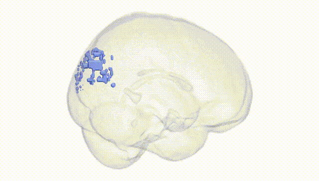 Full Brain White