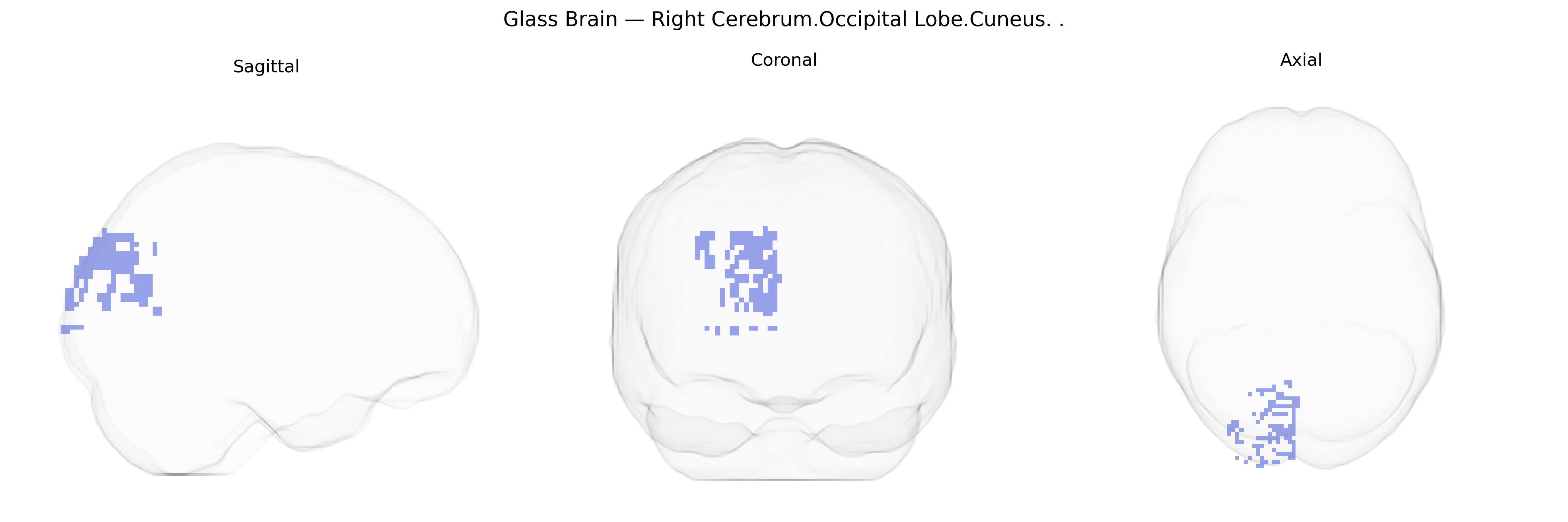 Triplanar Ghost Brain