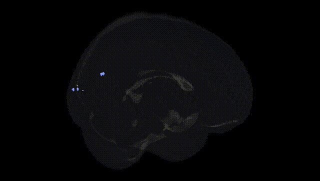 Full Brain Black
