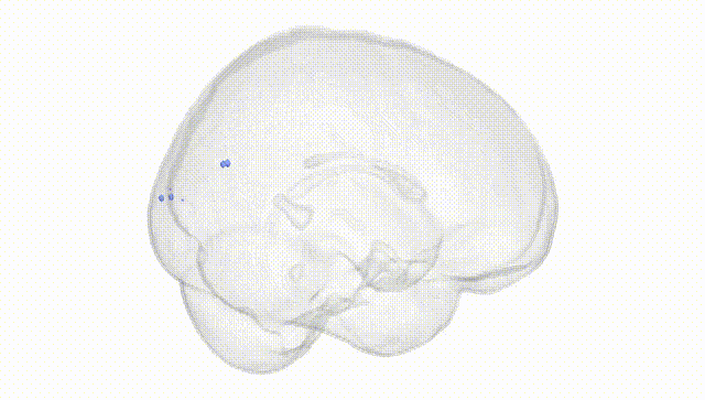 Full Brain White