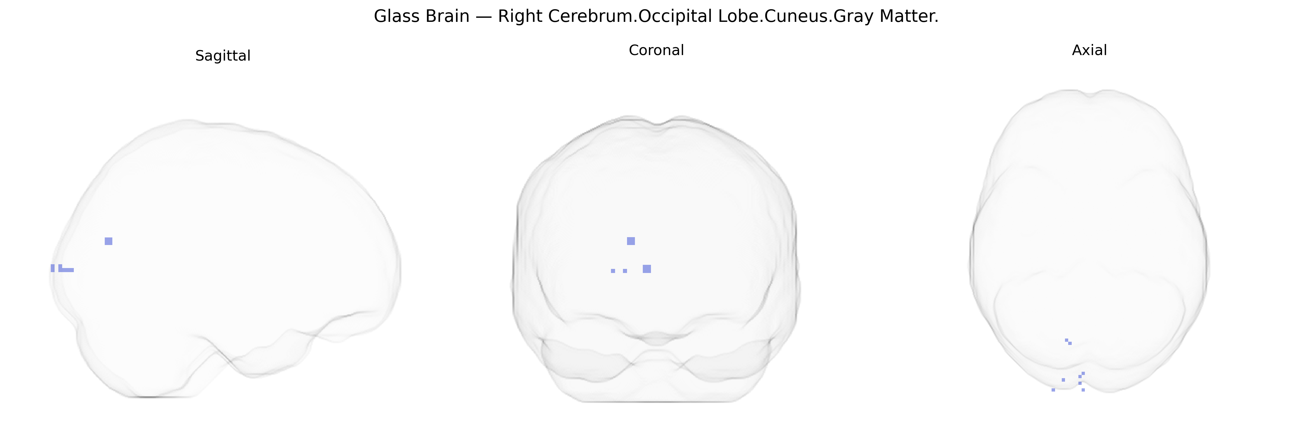 Triplanar Ghost Brain