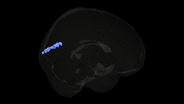 Full Brain Black