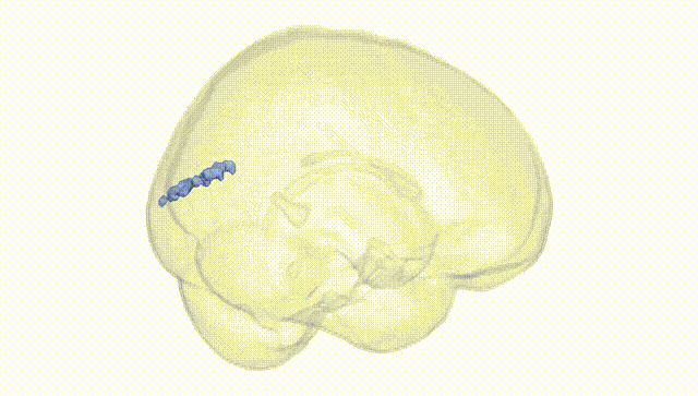 Full Brain White