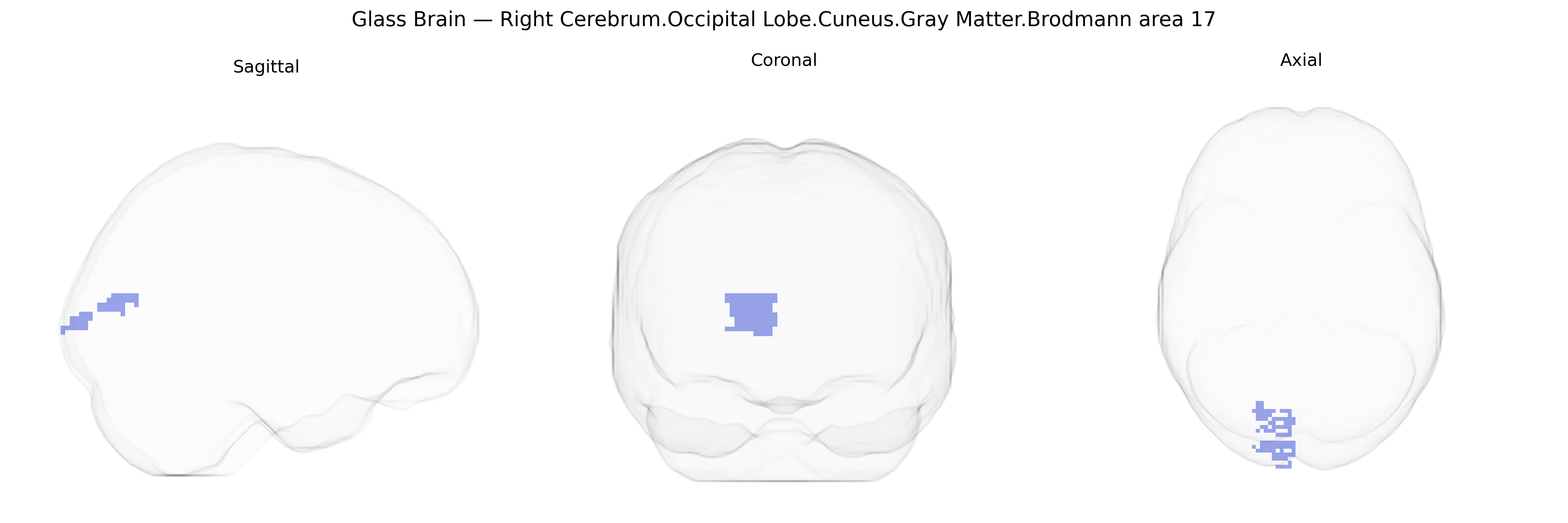 Triplanar Ghost Brain