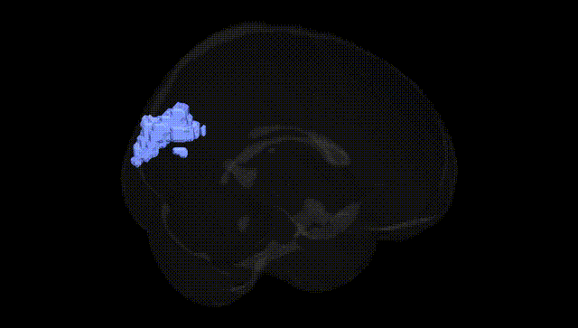 Full Brain Black