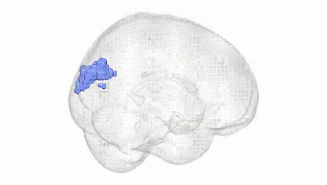 Full Brain White