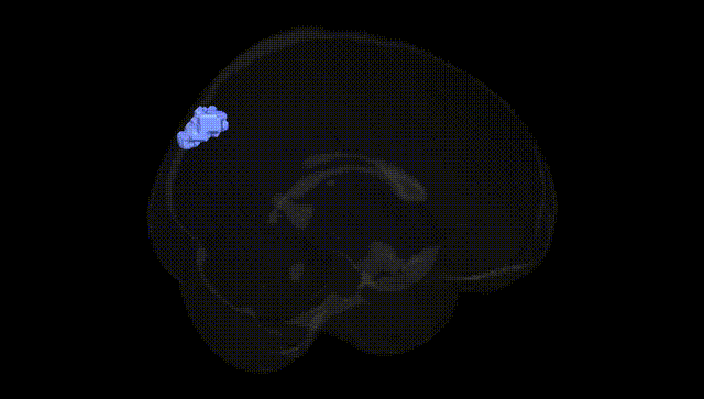 Full Brain Black