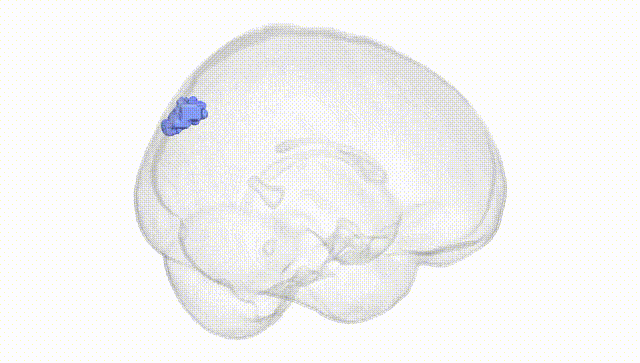 Full Brain White