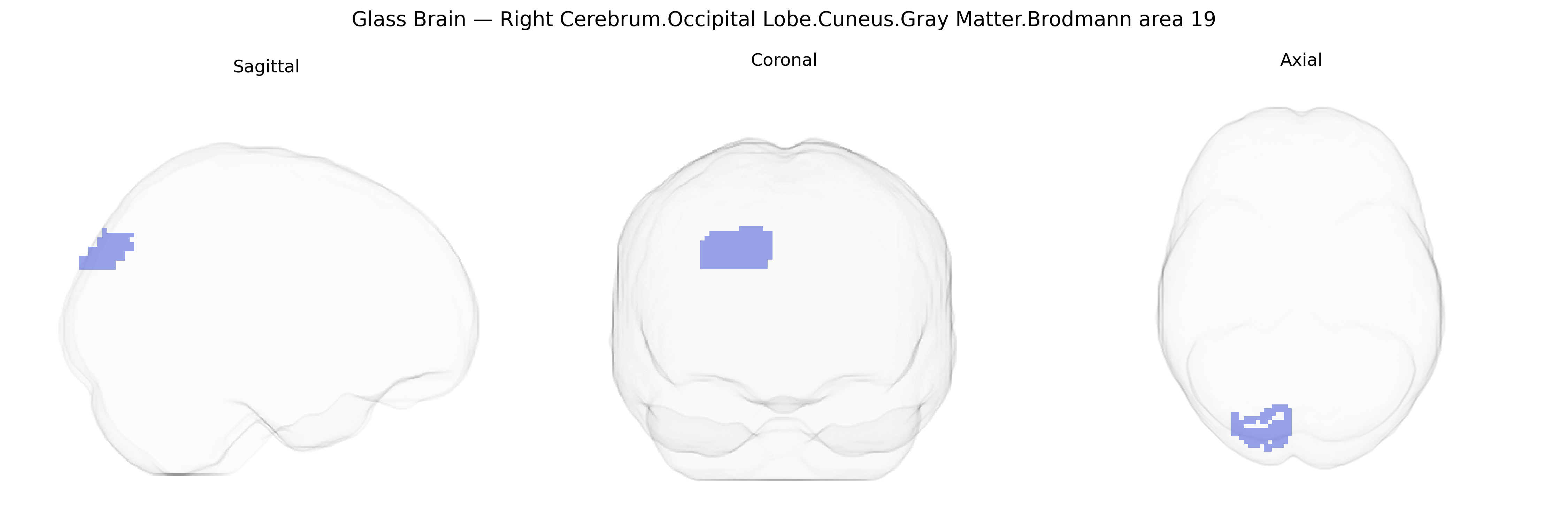 Triplanar Ghost Brain