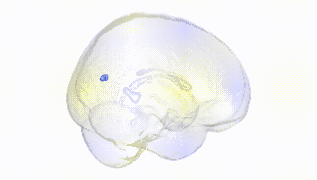 Full Brain White