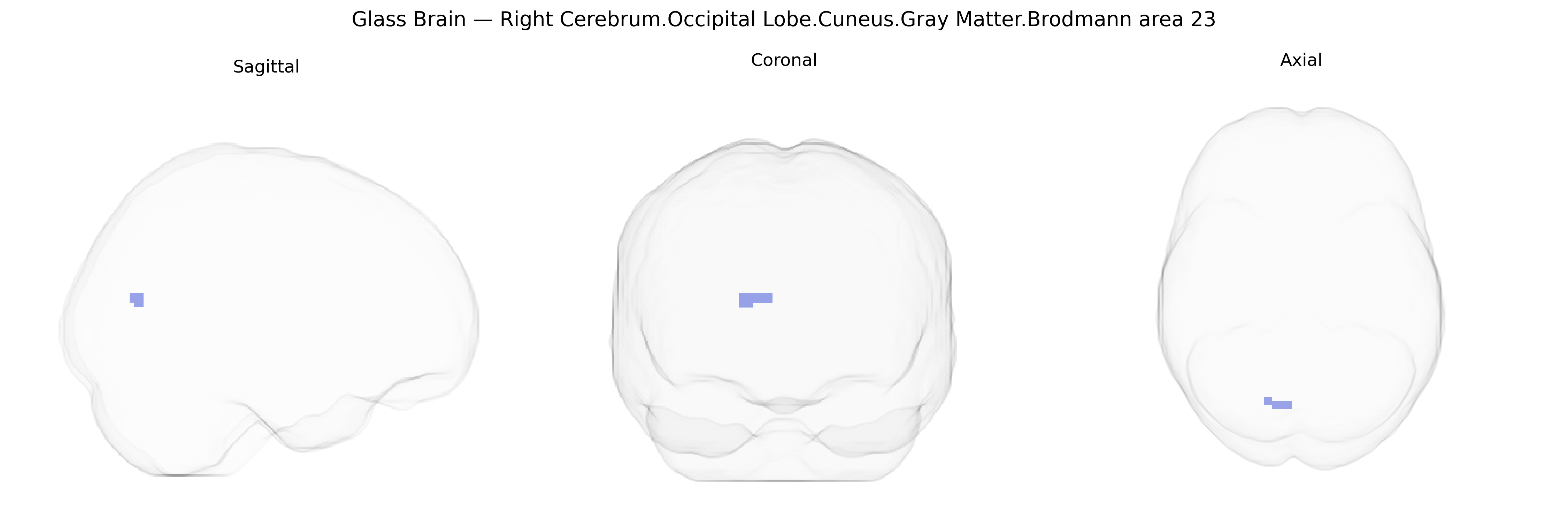 Triplanar Ghost Brain
