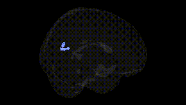 Full Brain Black