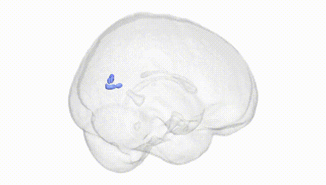 Full Brain White