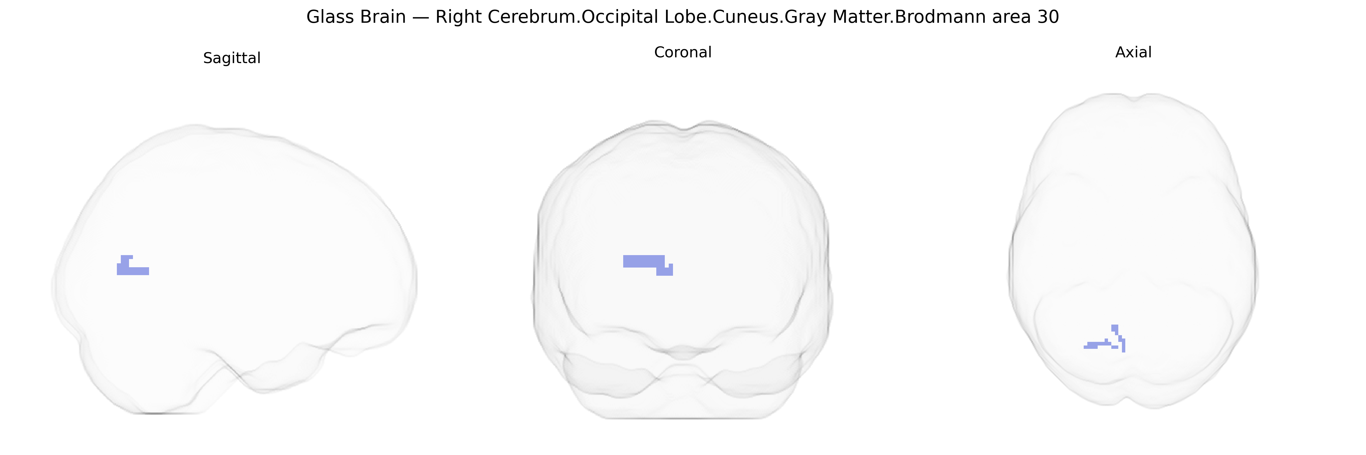 Triplanar Ghost Brain