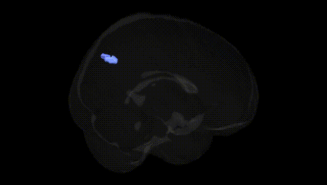 Full Brain Black