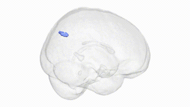 Full Brain White