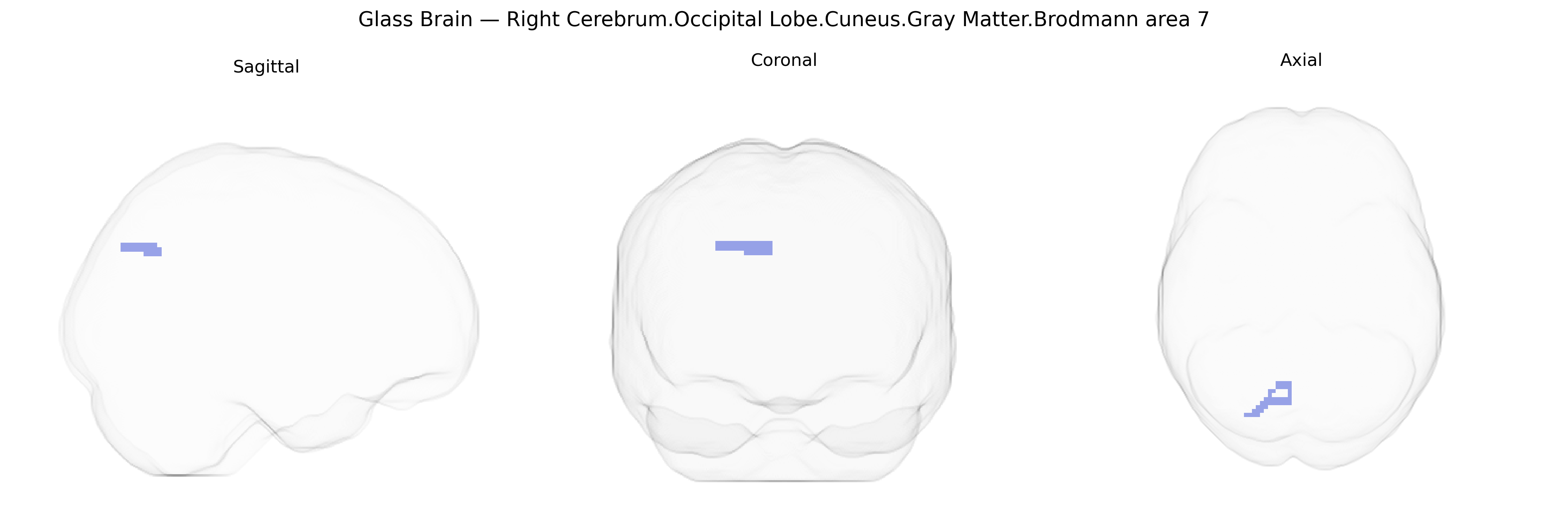 Triplanar Ghost Brain