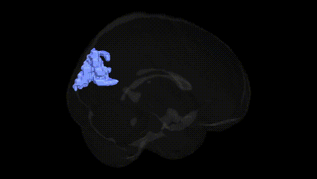Full Brain Black