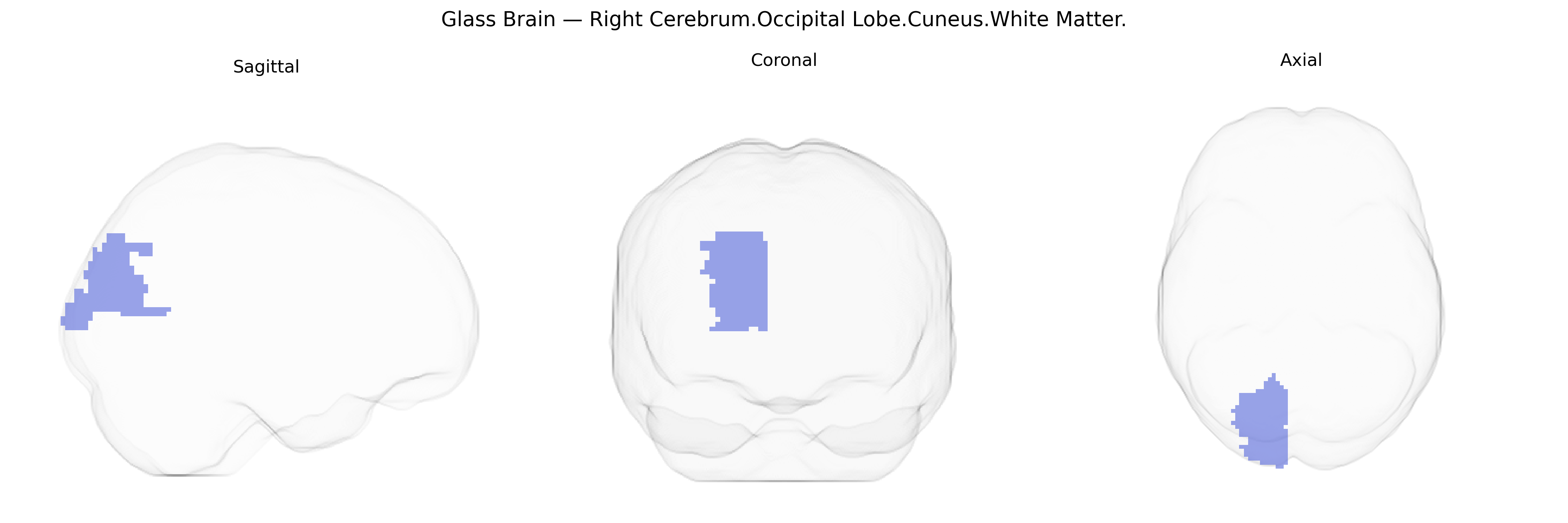 Triplanar Ghost Brain