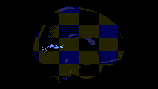 Full Brain Black