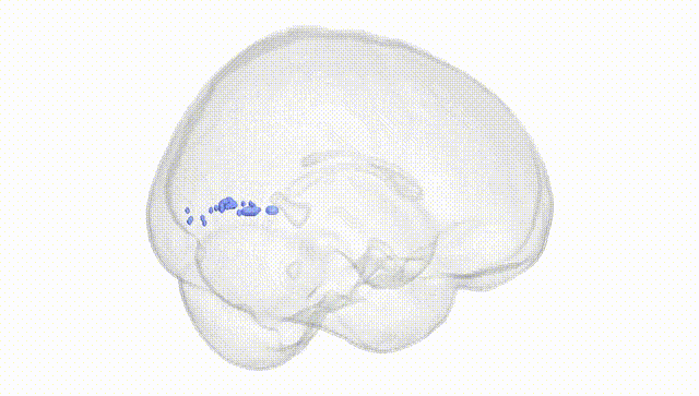 Full Brain White