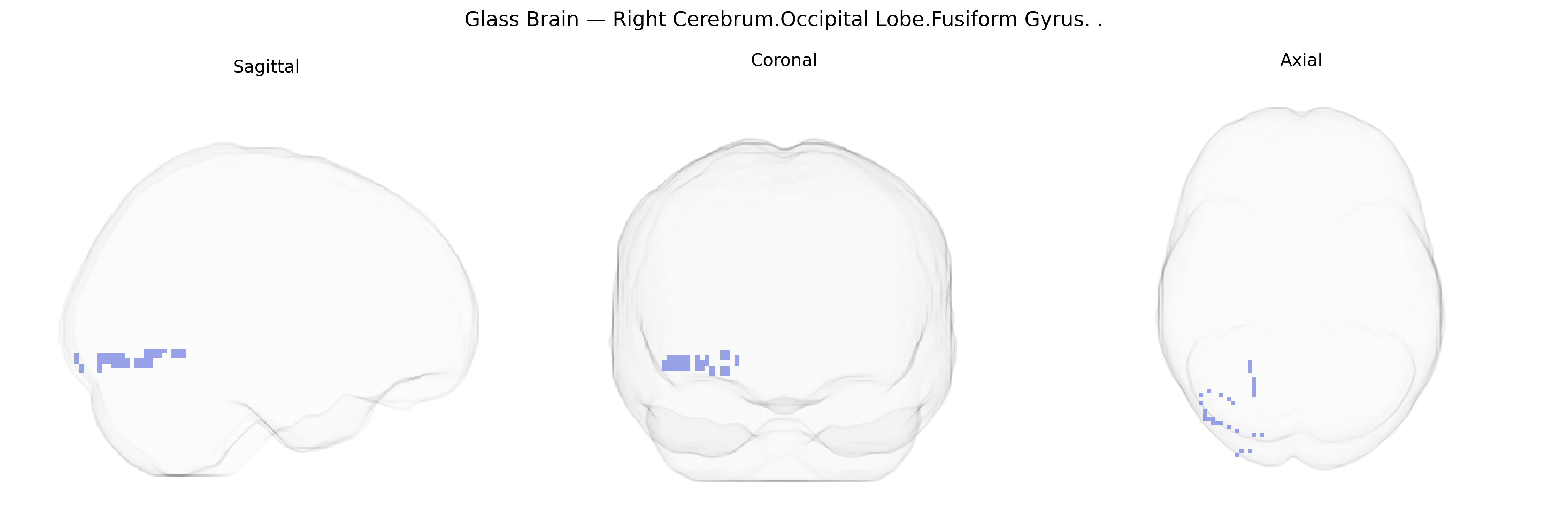 Triplanar Ghost Brain