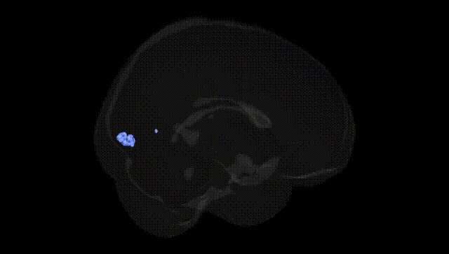 Full Brain Black