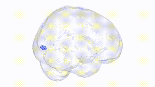 Full Brain White