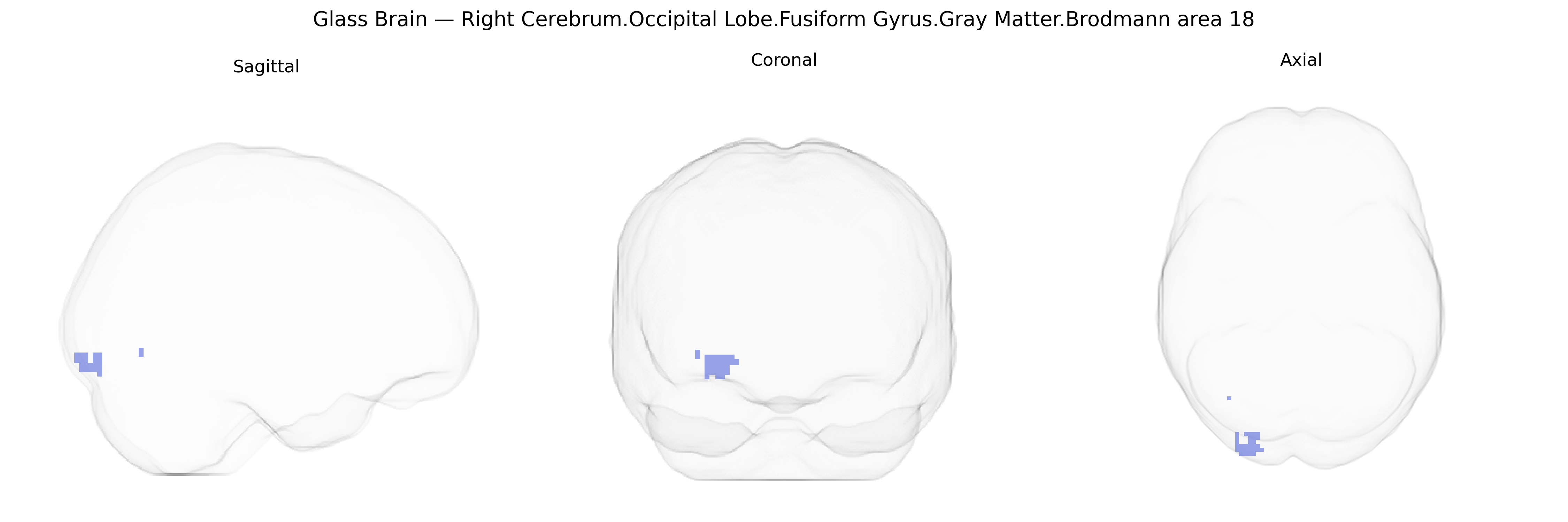 Triplanar Ghost Brain
