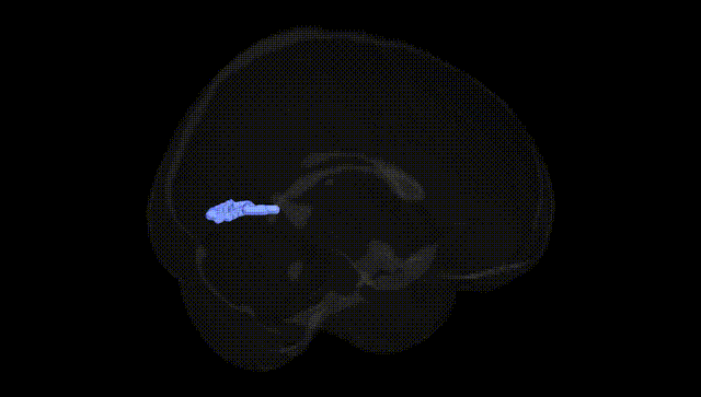 Full Brain Black