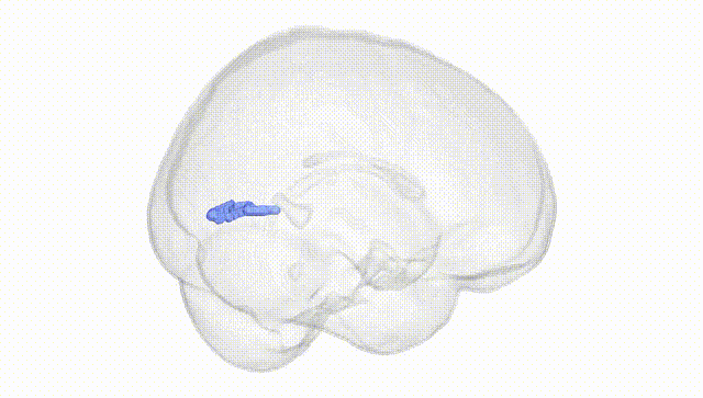 Full Brain White