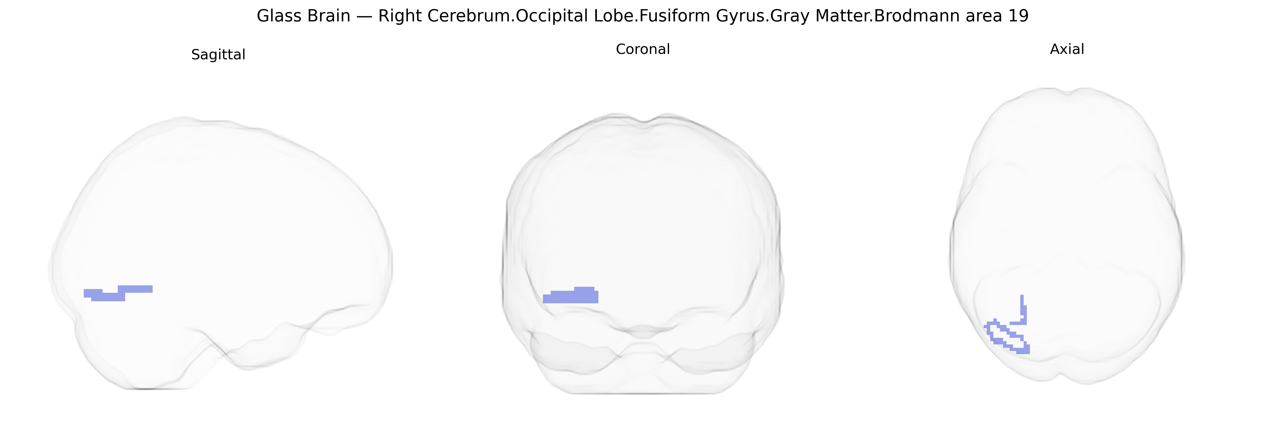 Triplanar Ghost Brain
