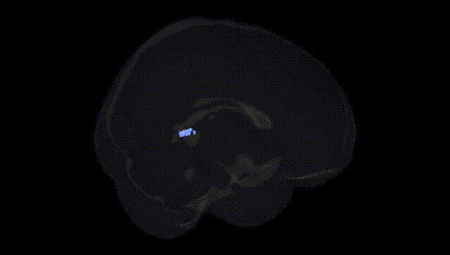 Full Brain Black