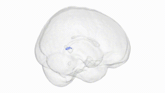 Full Brain White