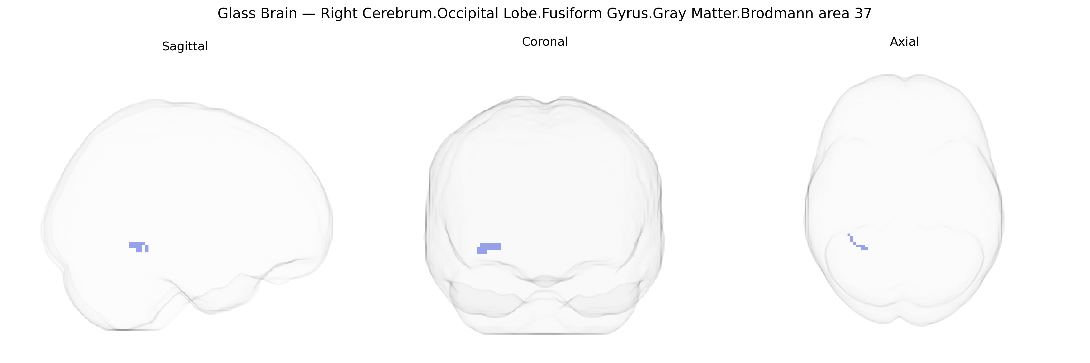 Triplanar Ghost Brain