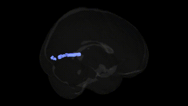 Full Brain Black