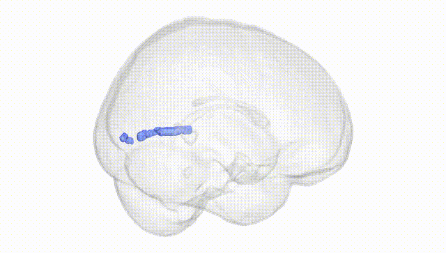 Full Brain White