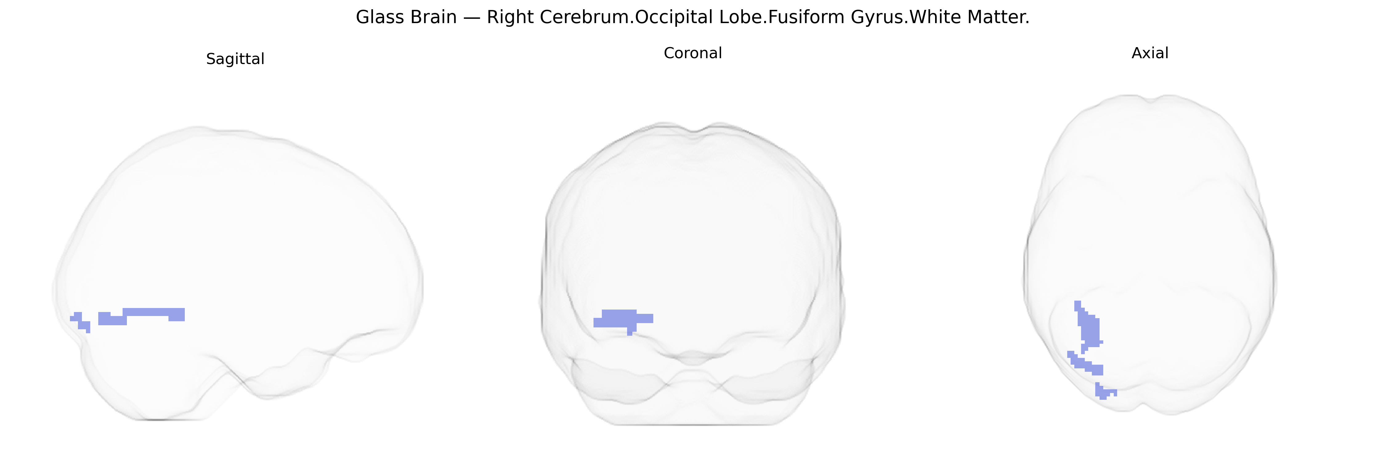 Triplanar Ghost Brain