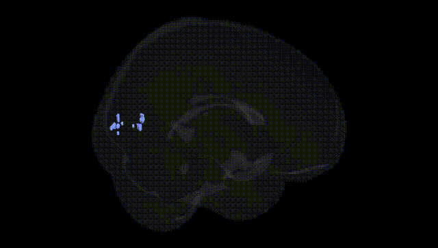 Full Brain Black