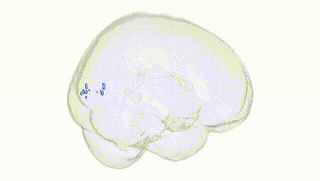 Full Brain White