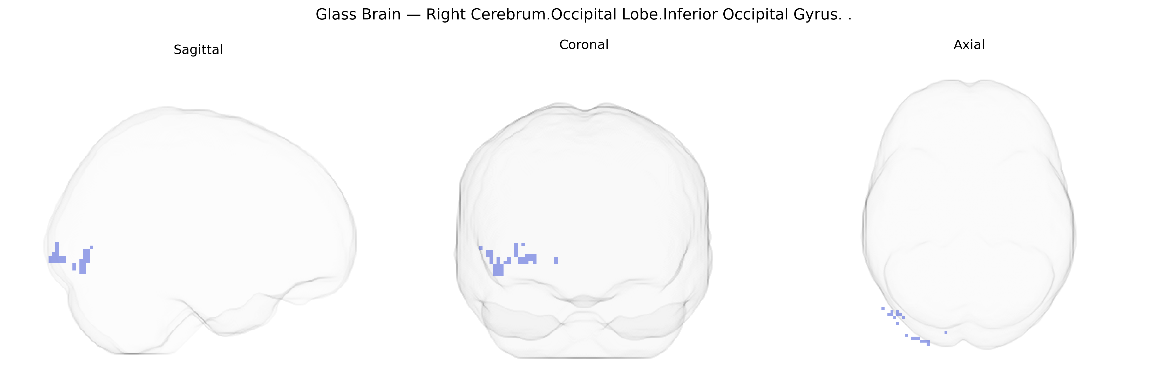 Triplanar Ghost Brain