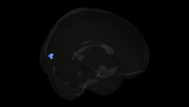 Full Brain Black