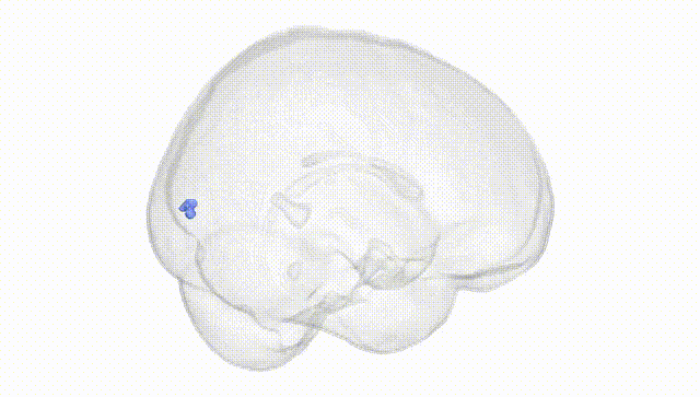 Full Brain White
